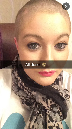 Sian shaved her head to raise money for the Miscarriage Association